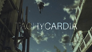 TACHYCARDIA